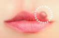 /album/fotogaleria/herpes-labial-jpg1/